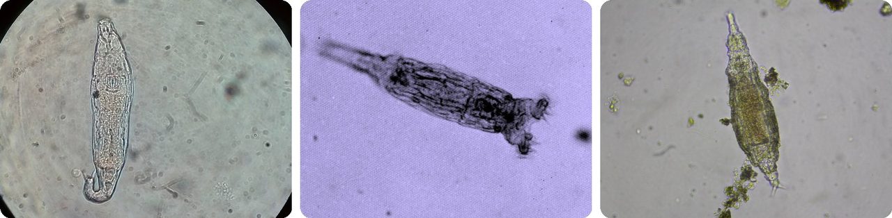 Bdelloid rotifers, tiny see-through animals, under a microscope