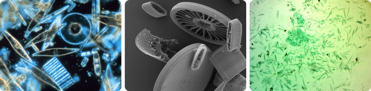 Diatoms, with patterned glassy shells, under the microscope