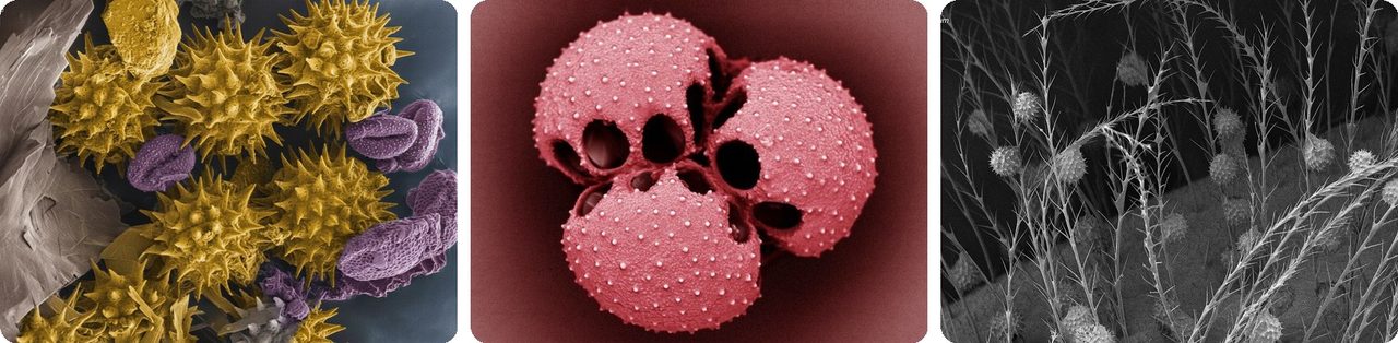 Spiky and bubbly pollen grains seen through an electron microscope