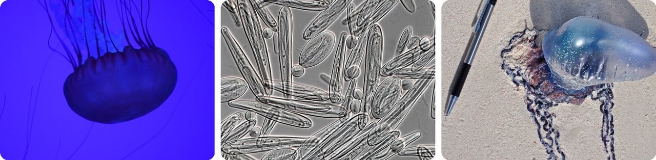 A sea nettle jellyfish, stinging capsules under a microscope, and a Portuguese man o' war